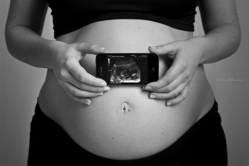 prenatal pregnancy - human development